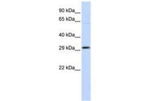 Image no. 1 for anti-Ovo-Like 2 (OVOL2) (C-Term) antibody (ABIN6740608)