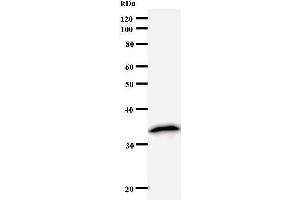 Western Blotting (WB) image for anti-Nudix (Nucleoside Diphosphate Linked Moiety X)-Type Motif 21 (NUDT21) antibody (ABIN933117) (NUDT21 antibody)