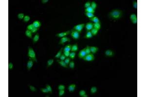 Immunofluorescence staining of PC-3 cells with ABIN7163969 at 1:100, counter-stained with DAPI. (KCNC3 antibody  (AA 638-745))