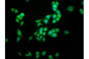 Immunofluorescence staining of PC-3 cells with ABIN7163969 at 1:100, counter-stained with DAPI.