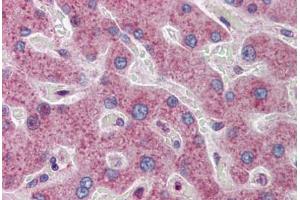 Human Liver: Formalin-Fixed, Paraffin-Embedded (FFPE) (ATF5 antibody  (AA 101-150))