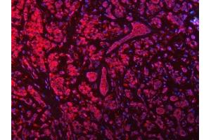 IF analysis of SEPTIN9 using anti-SEPTIN9 antibody (ABIN7600104). (Septin 9 antibody  (AA 15-282))