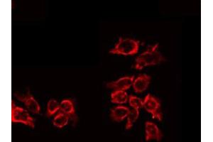 ABIN6267644 staining HuvEc by IF/ICC. (IL-10RA antibody  (pTyr496))