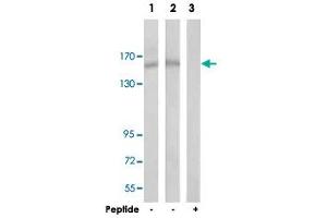 Western blot analysis of extracts from HUVEC cells (Lane 1) and COLO 205 cells (Lane 2 and lane 3), using SMARCC2 polyclonal antibody . (SMARCC2 antibody)