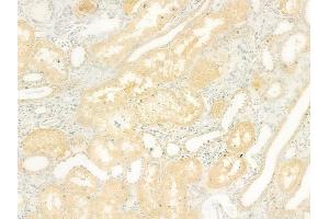 ABIN6264415 and ABIN6278511 at 1/100 staining human normal kidney tissue by IHC-P. (SLC26A5 antibody  (Internal Region))