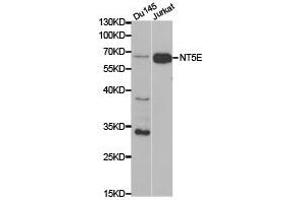 Western Blotting (WB) image for anti-5'-Nucleotidase, Ecto (CD73) (NT5E) antibody (ABIN1873965) (CD73 antibody)