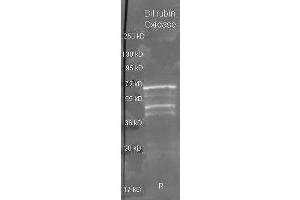 Goat anti Bilirubin Oxidase antibody  was used to detect Bilirubin Oxidase under reducing (R) conditions. (Bilirubin Oxidase antibody  (HRP))