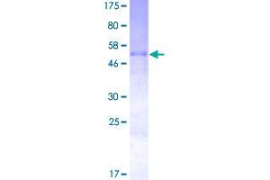 Oncostatin M (OSM) (AA 1-252) protein (GST tag)