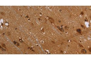 Immunohistochemistry of paraffin-embedded Human brain using FLNA Polyclonal Antibody at dilution of 1:40 (Filamin A antibody)