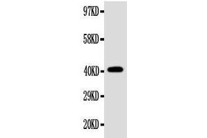 Anti-EDA antibody, Western blotting WB: SW620 Cell Lysate (Ectodysplasin A antibody  (Middle Region))