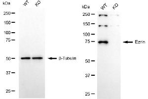 Western blotting analysis using ezrin antibody (ABIN7798552).