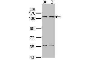 WB Image Sample (30 ug of whole cell lysate) A: A431 , B: H1299 7. (LIG1 antibody  (C-Term))