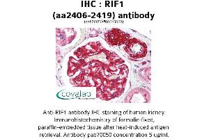 Image no. 1 for anti-RAP1 Interacting Factor Homolog (RIF1) (AA 2406-2419) antibody (ABIN1738875) (RIF1 antibody  (AA 2406-2419))
