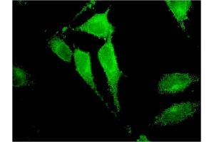 Immunofluorescence of monoclonal antibody to TRIM17 on HeLa cell. (TRIM17 / RNF16 antibody  (AA 75-184))