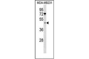 Western blot analysis of Islet-1 / ISL1 Antibody (Center) in MDA-MB231 cell line lysates (35ug/lane).