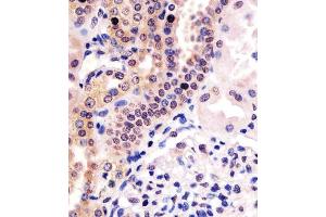 (ABIN6243947 and ABIN6578467) staining PHC3 in human kidney tissue sections by Immunohistochemistry (IHC-P - paraformaldehyde-fixed, paraffin-embedded sections).