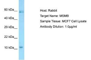Host: RabbitTarget Name: MSMBAntibody Dilution: 1. (MSMB antibody  (C-Term))