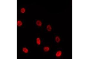 ABIN6275723 staining HepG2 by IF/ICC. (ZNF691 antibody  (Internal Region))