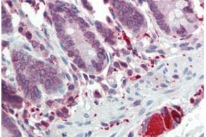 Human Small Intestine (formalin-fixed, paraffin-embedded) stained with TLR7 antibody ABIN334260 at 5 ug/ml followed by biotinylated goat anti-rabbit IgG secondary antibody ABIN481713, alkaline phosphatase-streptavidin and chromogen. (TLR7 antibody  (AA 706-728))