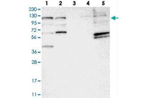 Western blot analysis of Lane 1: RT-4, Lane 2: U-251 MG, Lane 3: Human Plasma, Lane 4: Liver, Lane 5: Tonsil with C10orf118 polyclonal antibody  at 1:250-1:500 dilution.