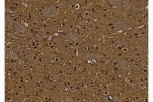ABIN6277588 at 1/100 staining Rat brain tissue by IHC-P. (BCL11A antibody  (Internal Region))