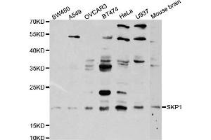 Western Blotting (WB) image for anti-S-Phase Kinase-Associated Protein 1 (SKP1) antibody (ABIN1874792) (SKP1 antibody)