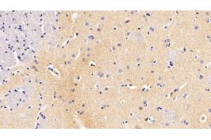 Immunohistochemistry (IHC) image for anti-Colony Stimulating Factor 3 Receptor (Granulocyte) (CSF3R) (AA 271-428) antibody (ABIN7438049)