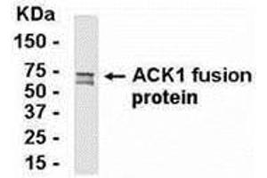 Western Blotting (WB) image for anti-tyrosine Kinase, Non-Receptor, 2 (TNK2) (AA 710-933) antibody (ABIN2468017) (TNK2 antibody  (AA 710-933))