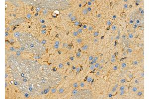 ABIN6259884 and ABIN6266962 at 1/100 staining Rat brain tissue by IHC-P. (ALDOC antibody  (C-Term))