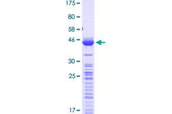 TPT1 Protein (AA 1-172) (GST tag)