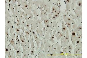 Immunoperoxidase of monoclonal antibody to ACD on formalin-fixed paraffin-embedded human heart tissue. (ACD antibody  (AA 1-544))