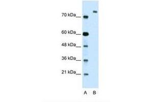 Image no. 1 for anti-Zinc Finger Protein 261 (ZMYM3) (AA 51-100) antibody (ABIN324361) (ZMYM3 antibody  (AA 51-100))