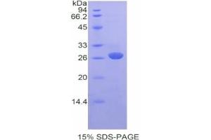 SDS-PAGE (SDS) image for Solute Carrier Family 27 (Fatty Acid Transporter), Member 5 (SLC27A5) ELISA Kit (ABIN6574285)