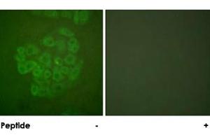 Immunofluorescence analysis of A-549 cells, using NR3C1 polyclonal antibody . (Glucocorticoid Receptor antibody)