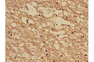 Immunohistochemistry of paraffin-embedded human brain tissue using ABIN7160905 at dilution of 1:100 (NDUFA5 antibody  (AA 38-114))