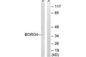 Western blot analysis of extracts from Jurkat cells, using BORG4 Antibody. (CDC42EP4 antibody  (AA 201-250))