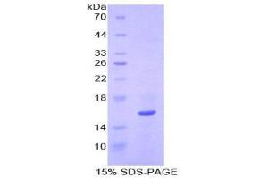 SDS-PAGE (SDS) image for Quiescin Q6 Sulfhydryl Oxidase 1 (QSOX1) (AA 394-519) protein (His tag) (ABIN2121977)