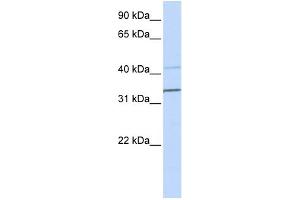 WB Suggested Anti-PYHIN1 Antibody Titration:  0. (PYHIN1 antibody  (N-Term))