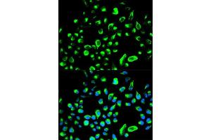 Immunofluorescence analysis of HeLa cells using YWHAQ antibody. (14-3-3 theta antibody  (AA 1-245))