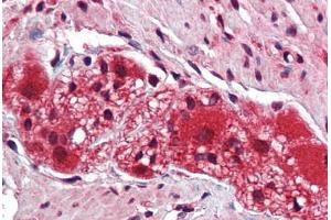 Human Colon, Myenteric Plexus: Formalin-Fixed, Paraffin-Embedded (FFPE) (KDM2B antibody  (C-Term))