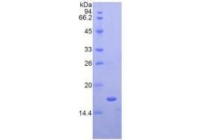 SDS-PAGE of Protein Standard from the Kit (Highly purified E. (APOA1 ELISA Kit)