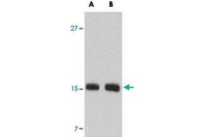 Western blot analysis of SKA2 in NIH/3T3 cell lysate with SKA2 polyclonal antibody  at (A) 0. (FAM33A antibody  (N-Term))