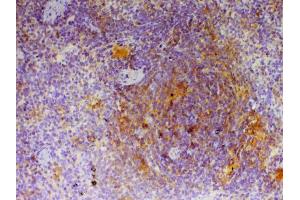 IHC analysis of CD40L using anti-CD40L antibody . (CD40 Ligand antibody  (AA 107-260))