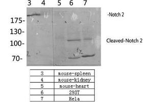 Western Blot (WB) analysis: Please contact us for more details. (NOTCH2 antibody  (Asp1733, cleaved))