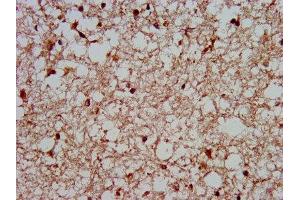 IHC image of ABIN7155794 diluted at 1:400 and staining in paraffin-embedded human brain tissue performed on a Leica BondTM system. (MKX antibody  (AA 157-305))