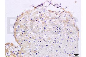 Formalin-fixed and paraffin embedded mouse heart labeled with Anti AT2R/AT1 Polyclonal Antibody, Unconjugated (ABIN668616) at 1:200 followed by conjugation to the secondary antibody and DAB staining. (Angiotensin II Type 2 Receptor antibody)