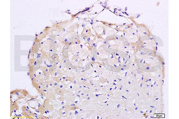 Angiotensin II Type 2 Receptor antibody