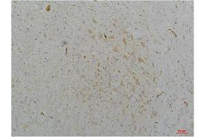 Immunohistochemistry (IHC) analysis of paraffin-embedded Mouse Brain Tissue using Cav2. (CACNA1B antibody)
