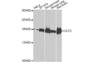 Western blot analysis of extracts of various cell lines, using CLTC antibody. (Clathrin Heavy Chain (CLTC) antibody)