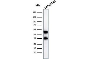 Western Blot Analysis of pancreatic tissue lysate using CPA1 Mouse Monoclonal Antibody (CPA1/2712). (CPA1 antibody)